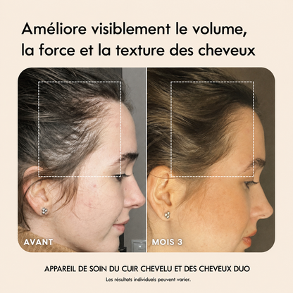 Mirant ScalpCare™ — Brosse LED 4-en-1 pour des cheveux visiblement plus forts + 2 sérums inclus